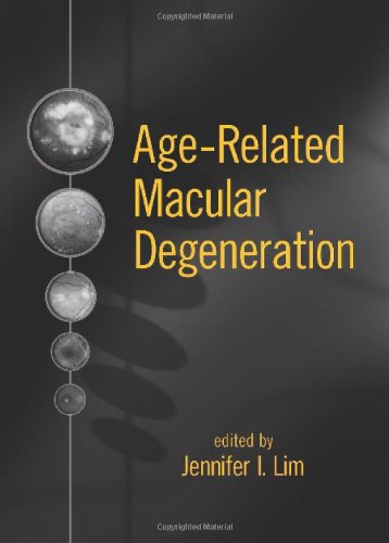 Age-Related Macular Degeneration