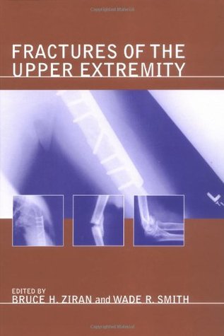 Fractures of the Upper Extremity