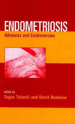 Endometriosis