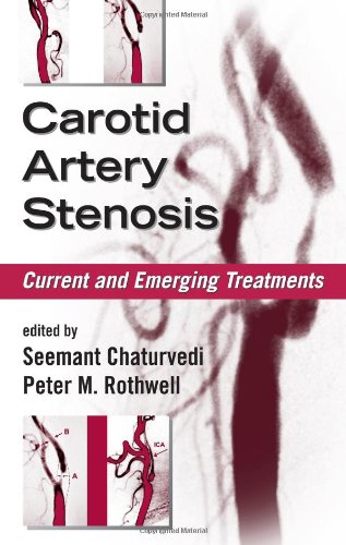 Carotid Artery Stenosis