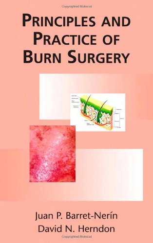 Principles and Practice of Burn Surgery