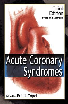 Acute Coronary Syndromes