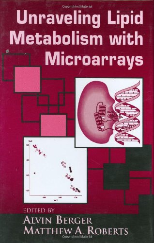 Unraveling Lipid Metabolism With Microarrays