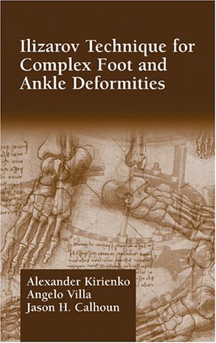 Ilizarov Technique for Complex Foot and Ankle Deformities