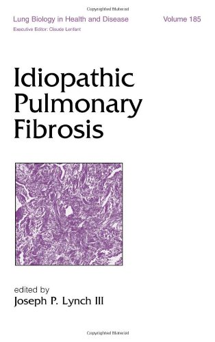 Idiopathic Pulmonary Fibrosis