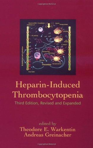 Heparin-Induced Thrombocytopenia