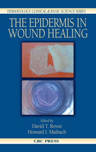 The Epidermis in Wound Healing