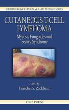 Cutaneous T-Cell Lymphoma