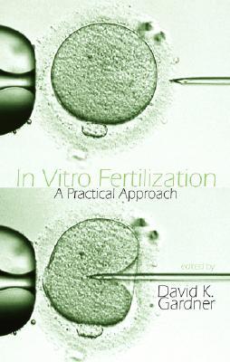 In Vitro Fertilization