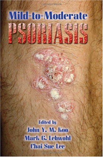 Mild-To-Moderate Psoriasis