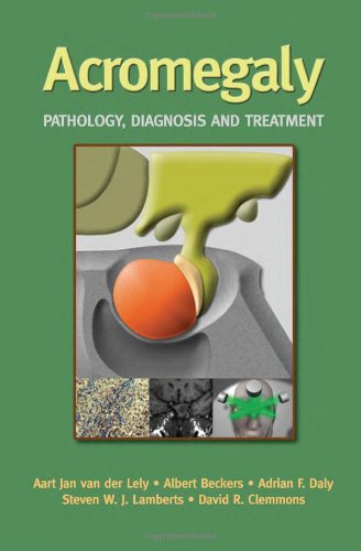 Acromegaly