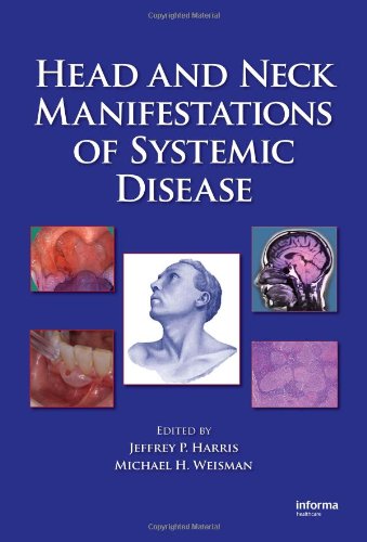 Head and Neck Manifestations of Systemic Disease