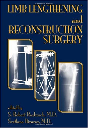 Limb Lengthening and Reconstruction Surgery