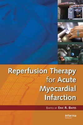 Reperfusion Therapy for Acute Myocardial Infarction