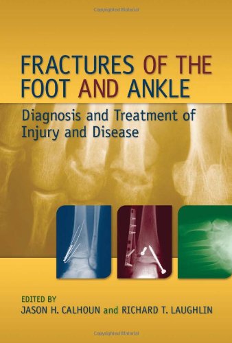 Fractures of the Foot and Ankle