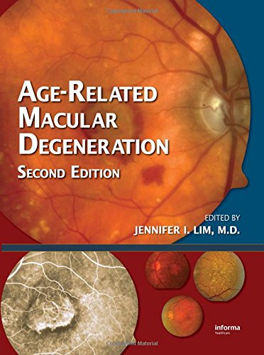 Age-Related Macular Degeneration