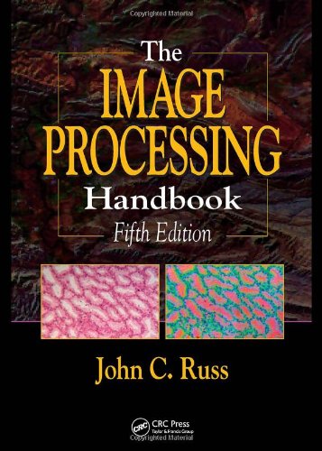 The Image Processing Handbook