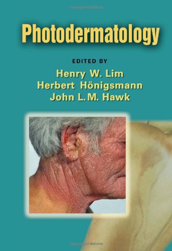 Photodermatology