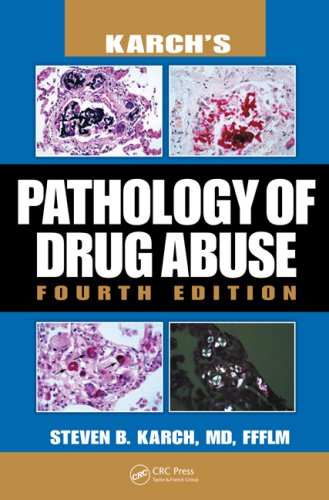 Karch's Pathology of Drug Abuse