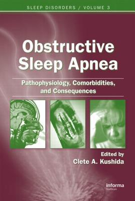 Obstructive Sleep Apnea