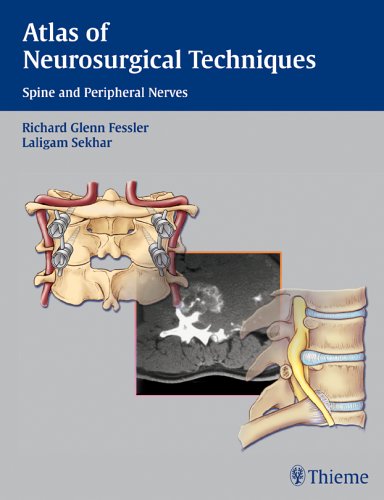 Atlas of Neurosurgical Techniques