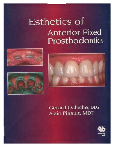 Esthetics of Anterior Fixed Prosthodontics