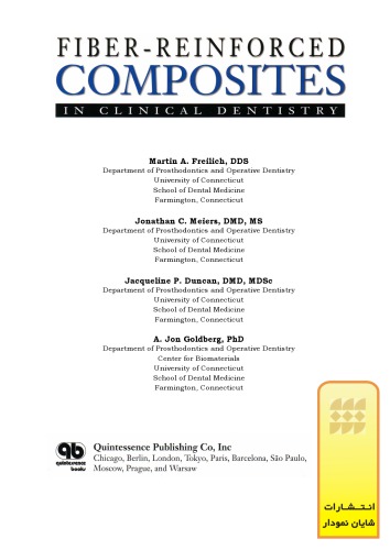 Fiber Reinforced Composites In Clinical Dentistry