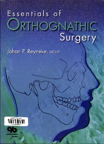 Essentials of Orthognathic Surgery