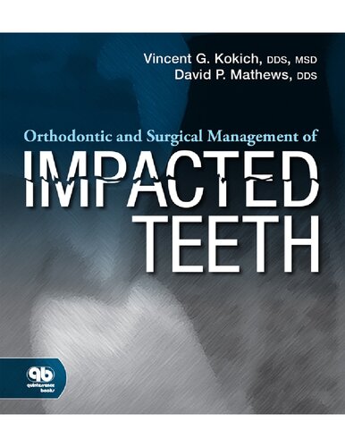 Orthodontic and Surgical Management of Impacted Teeth