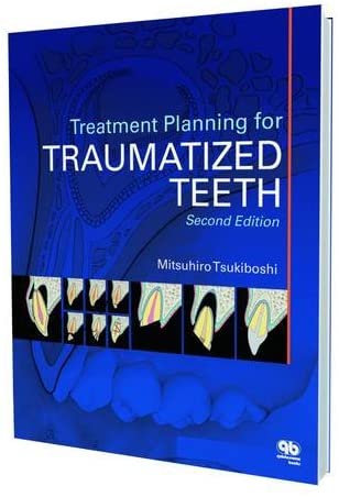 Treatment Planning for Traumatized Teeth, 2nd Edition