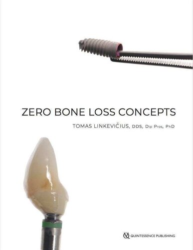 Zero Bone Loss Concepts