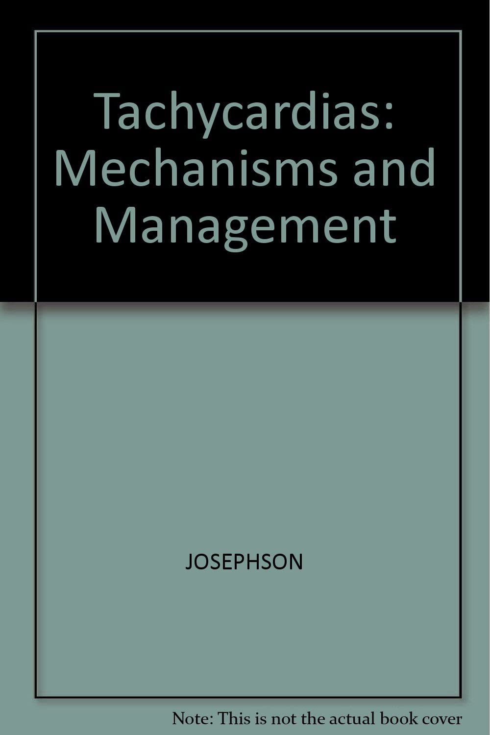 Ventricular Tachycardia: Mechanisms and Management