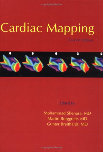 Cardiac Mapping