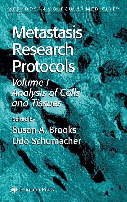 Metastasis Research Protocols (Methods in Molecular Medicine)