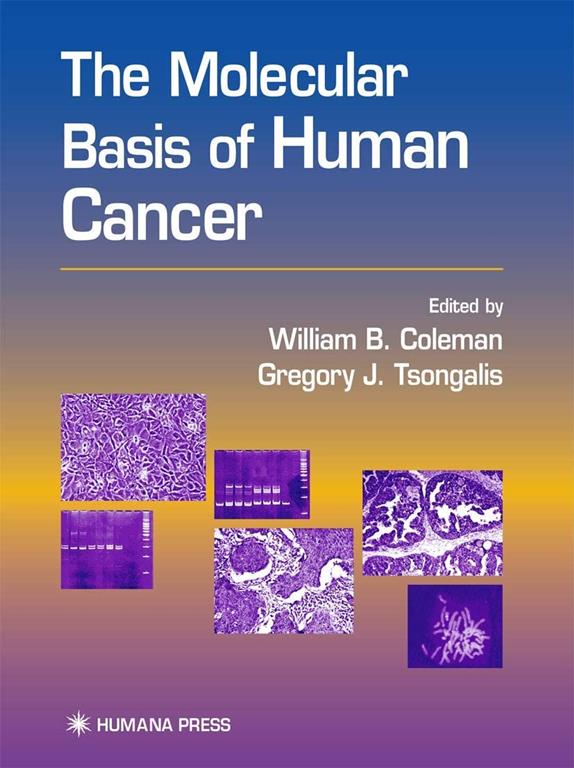 The Molecular Basis of Human Cancer