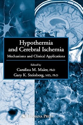 Hypothermia and Cerebral Ischemia