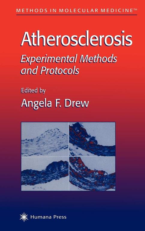 Atherosclerosis: Experimental Methods and Protocols (Methods in Molecular Medicine, 52)