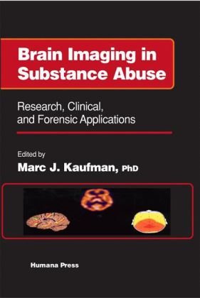 Brain Imaging in Substance Abuse: Research, Clinical, and Forensic Applications (Forensic Science and Medicine)