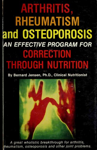 Arthritis, Rheumatism &amp; Osteoporosis