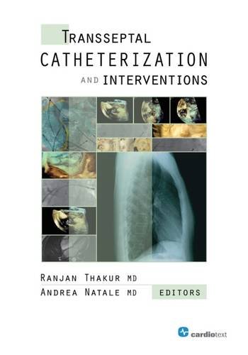 Transseptal Catheterization And Interventions