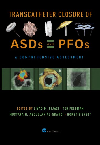 Transcatheter Closure of Asds and Pfos