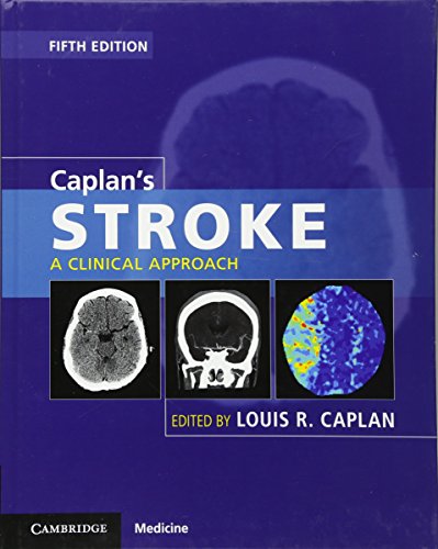 Caplan's Stroke