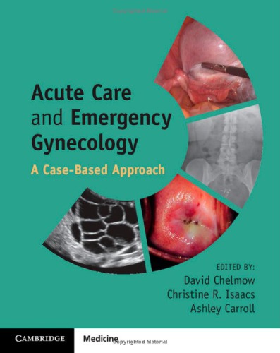 Acute Care and Emergency Gynecology