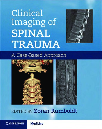 Clinical Imaging of Spinal Trauma