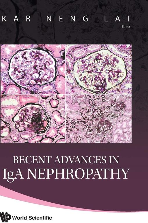 RECENT ADVANCES IN IGA NEPHROPATHY