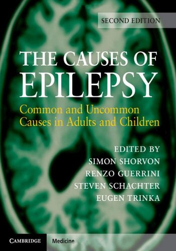 The Causes of Epilepsy