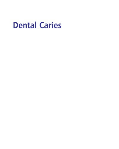 Dental Caries