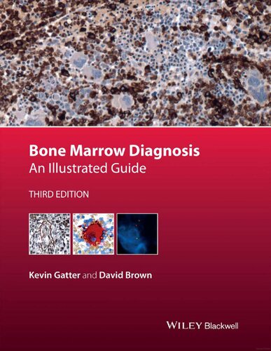 Bone Marrow Diagnosis