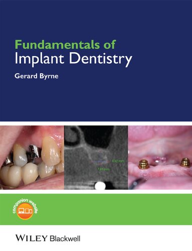 Fundamentals of Implant Dentistry