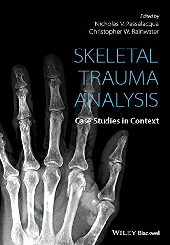 Skeletal Trauma Analysis